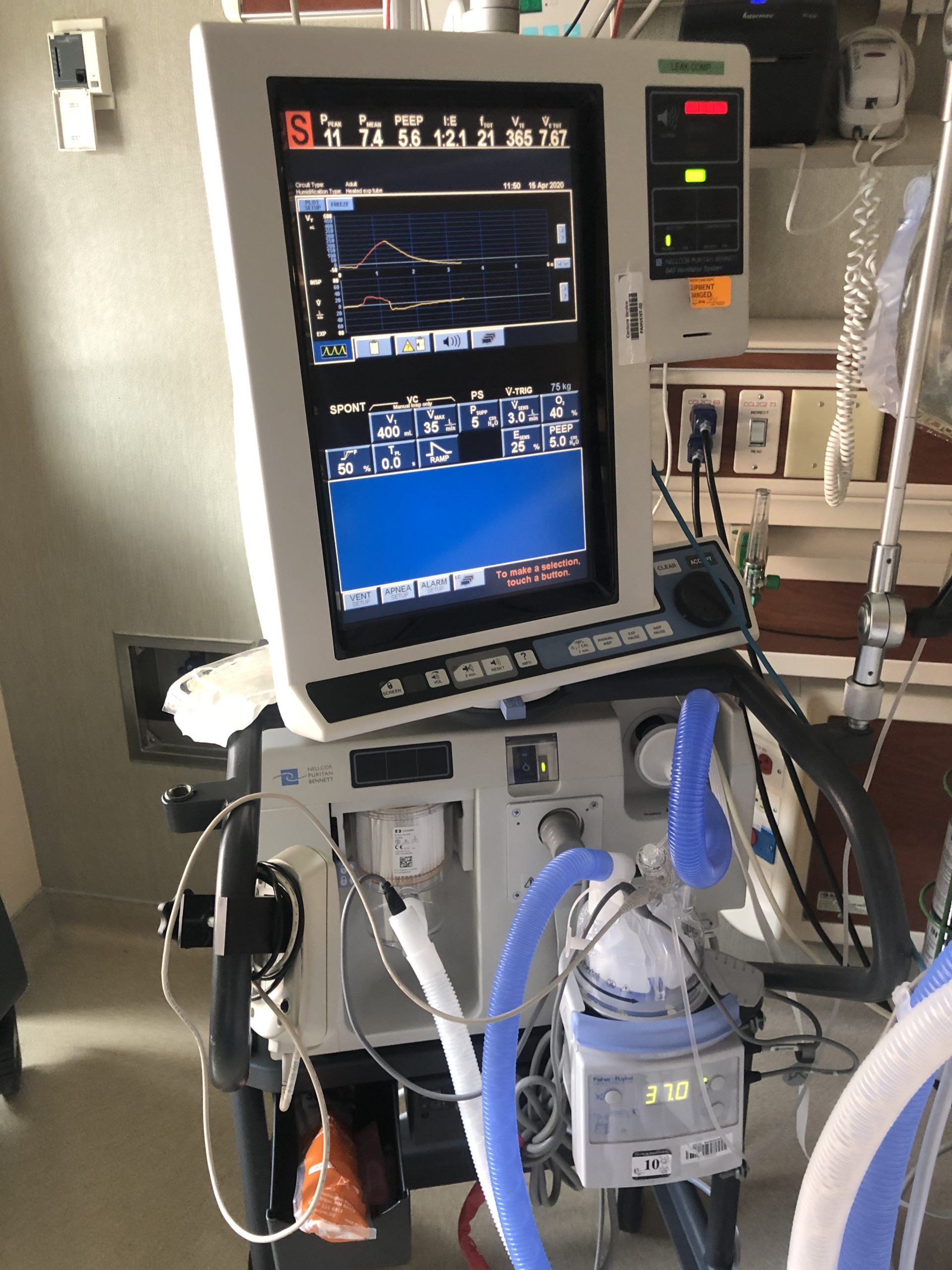 What Is a Medical Ventilator & How Does It Work?